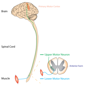 Motor Neurone Disease