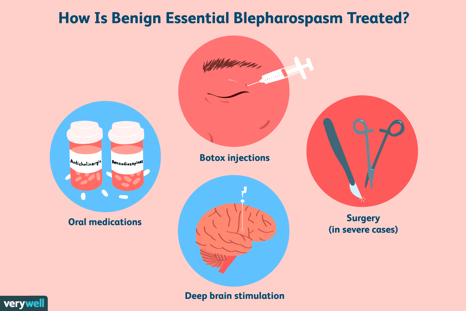 Benign Essential