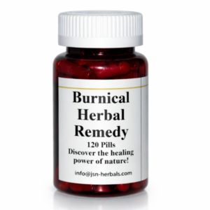 Burnical Burning Mouth Syndrome Symptoms, Causes and Treatment