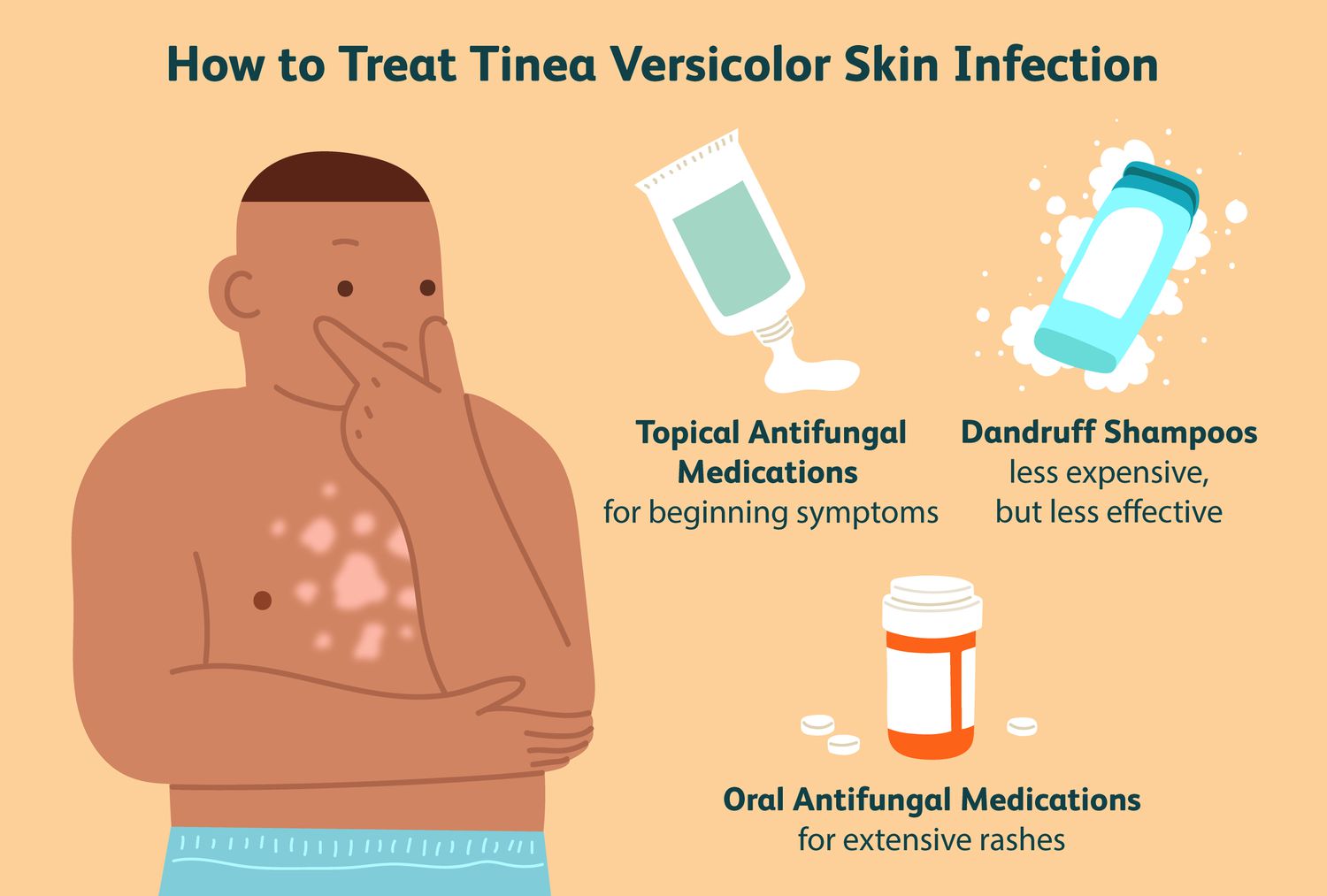 Tinea Versicolor: How to Identify and Manage This Common Skin Condition